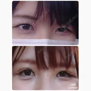 共立美容外科 大宮院口コミ