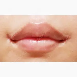 聖心美容クリニック 大阪院口コミ