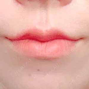 ルラ美容クリニック 新宿院口コミ