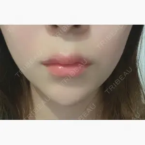BIANCA銀座口コミ