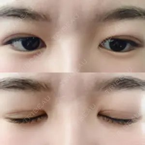 札幌ル・トロワ ビューティクリニックVogue口コミ