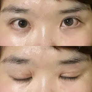 心斎橋コムロ美容外科クリニック口コミ