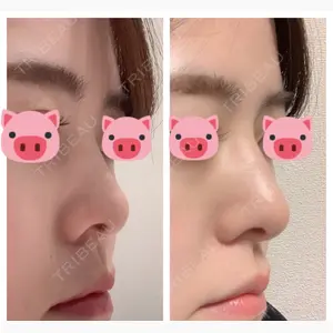 BIANCA銀座口コミ