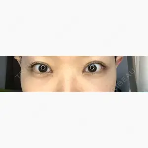 心斎橋コムロ美容外科クリニック口コミ