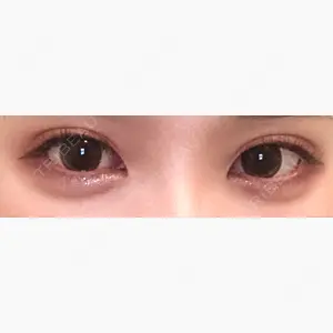 共立美容外科 大宮院口コミ