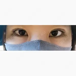 赤坂クリニック口コミ