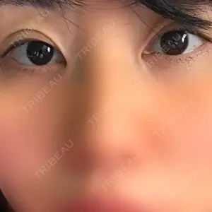 みやび形成外科口コミ