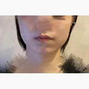 牧野美容クリニック口コミ