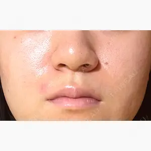 銀座よしえクリニック 銀座院口コミ