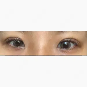 聖心美容クリニック 札幌院口コミ