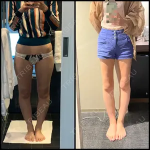 キルシェクリニック口コミ