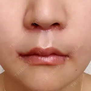 湘南美容クリニック 新宿本院口コミ