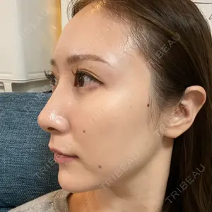 BIANCA銀座口コミ