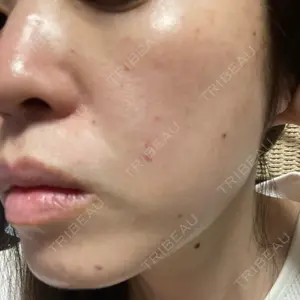 HSクリニック口コミ