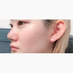 赤坂プレミアクリニック口コミ