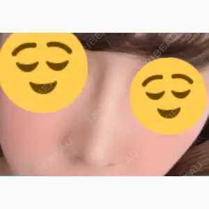 オペラ整形外科口コミ
