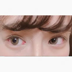 オペラ整形外科口コミ