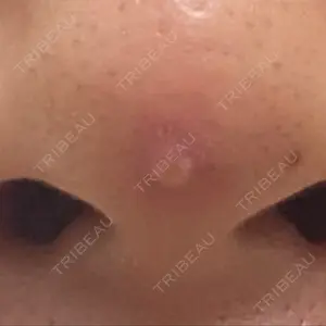 あらなみクリニック 千葉院口コミ