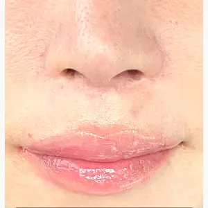 ヴェリテクリニック 大阪院口コミ