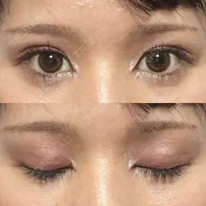 大阪雅美容外科口コミ