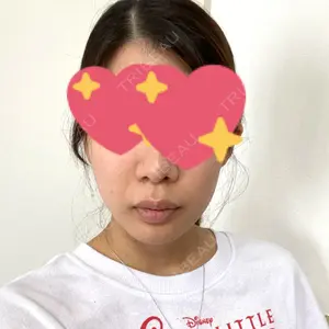 あつぎ美容クリニック口コミ