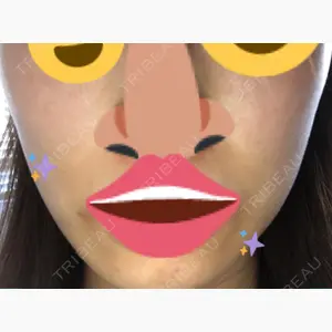 おおしま皮膚科口コミ