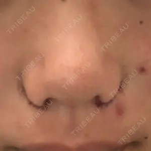 ツツイ美容外科口コミ