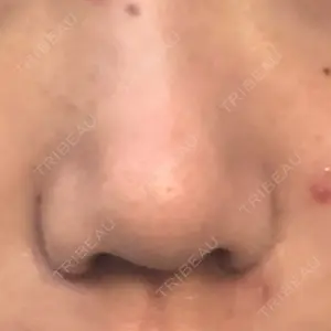 ツツイ美容外科口コミ