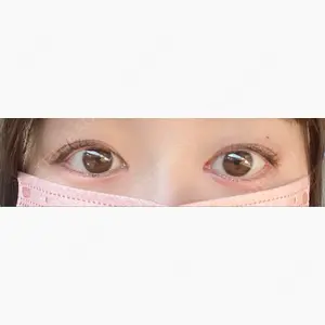 東京イセアクリニック口コミ