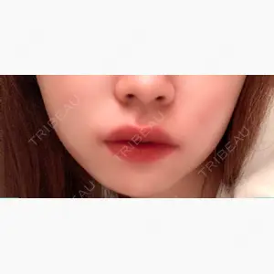銀座フェイスクリニック（小顔整形・輪郭整形專門）口コミ