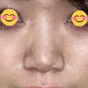 ヒルズ美容クリニック口コミ