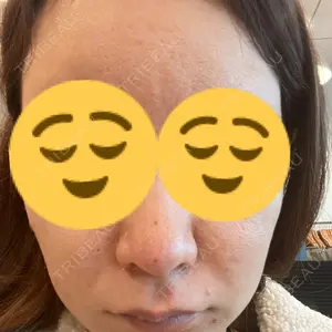 東京ブランシェクリニック口コミ