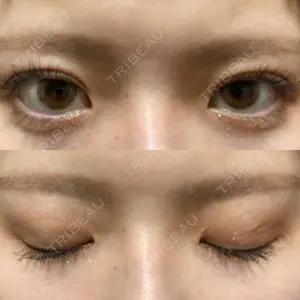 みやび形成外科口コミ