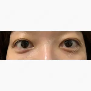 銀座みゆき通り美容外科 東京本院口コミ