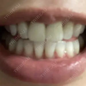 Lagform Tokyo表参道FMクリニック口コミ