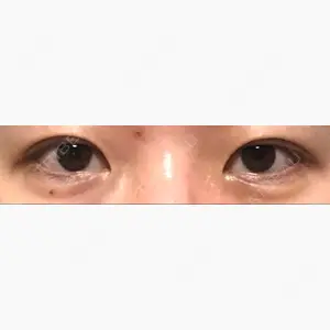 烏丸御池ビューティークリニック口コミ