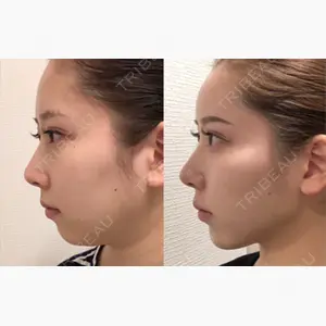 アリエル美容クリニック 大宮院口コミ