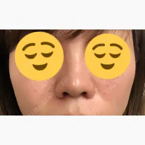 BIANCA銀座口コミ