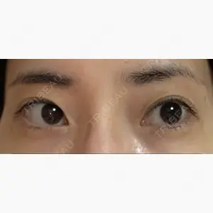 シエルクリニック口コミ