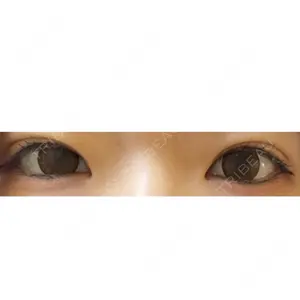 烏丸御池ビューティークリニック口コミ