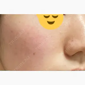 烏丸御池ビューティークリニック口コミ