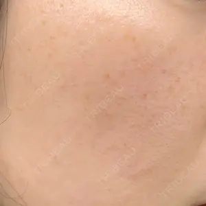 品川美容外科 札幌院口コミ