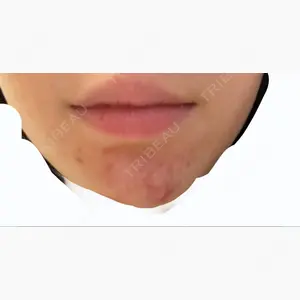 品川スキンクリニック表参道院口コミ