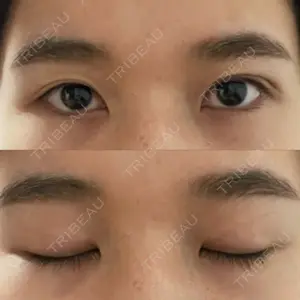 湘南美容クリニック 赤坂見附院口コミ