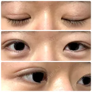 蘇春堂形成外科口コミ