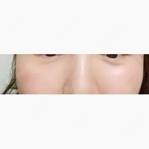 湘南美容クリニック 大阪心斎橋院口コミ