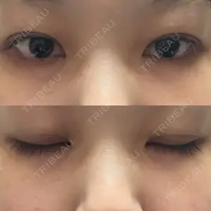 水の森美容クリニック 東京新宿院口コミ