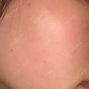 品川スキンクリニック岡山院口コミ