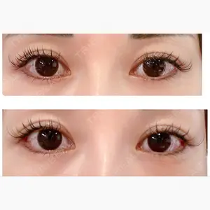 A CLINIC（エークリニック） 銀座院口コミ