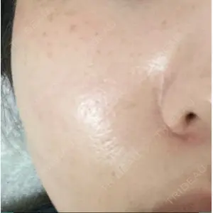 品川スキンクリニック表参道院口コミ